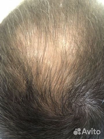 Набор от выпадения волос biological hairconcept