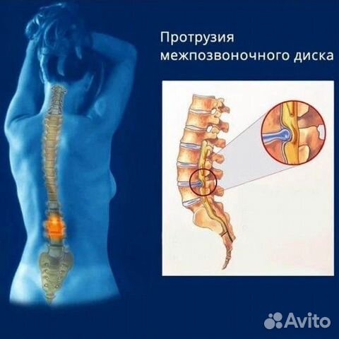 Массаж