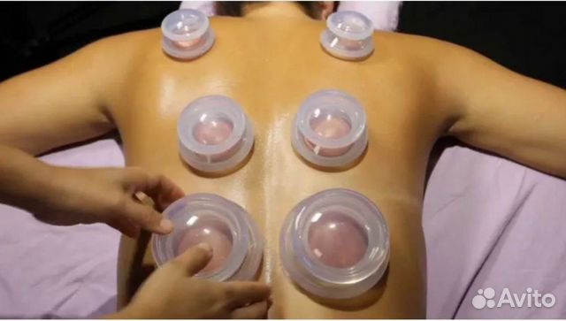 Вакуумные банки силиконовые набор 4 шт