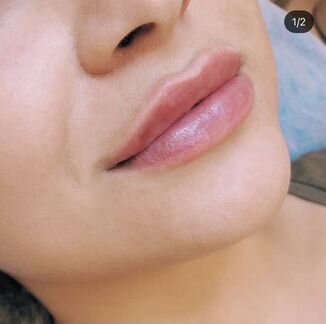 Врач дерматолог, косметолог