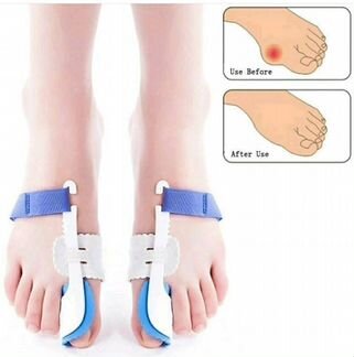 Вальгусная шина ночная